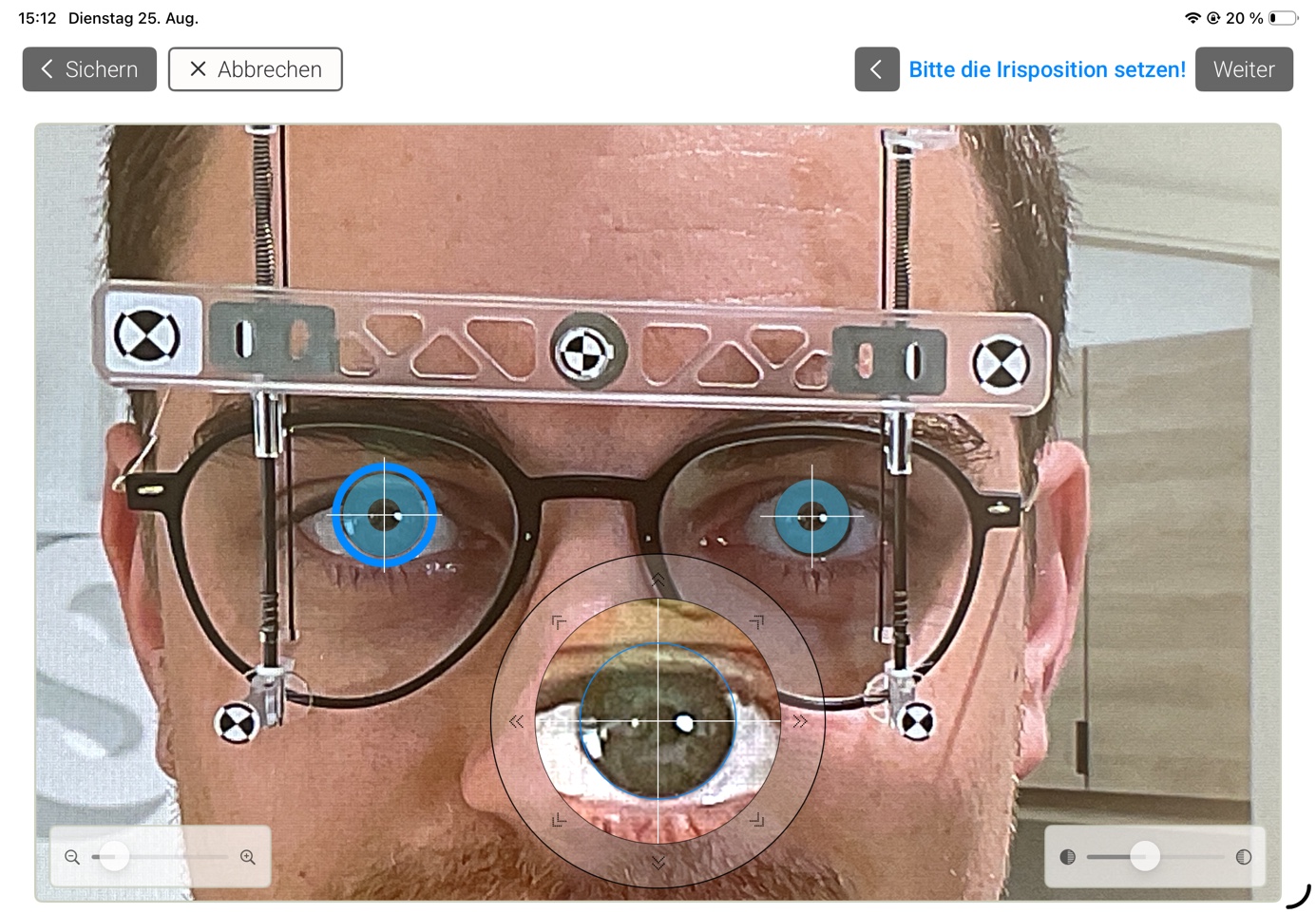 Frontaleditor zum Setzen der Irisposition